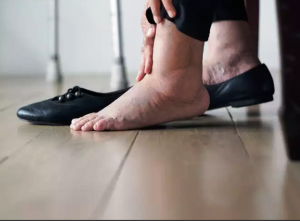 Swollen feet: पैर और घुटनों की सूजन को हल्‍के में लेने की न करें भूल, हो सकती है यह गंभीर बीमारी