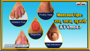 हेल्थ/Monsoon Tips : दाद, खाज खुजली से लेकर मानसून में होने वाली इन फंगल इंफेक्शन को ऐसे करें दूर
