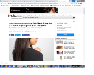 Home Remedies For Dandruff: सिर में डैंडरफ की वजह से हो रही है परेशानी, तो इन घरेलू तीरकों से पाएं इससे छुटकारा