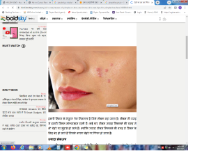 इन 8 आदतों की वजह से होते हैं पिंपल्स, तुरंत बदल डालें