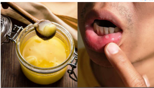 इन 4 बीमारियों में फायदेमंद है देसी घी का सेवन, सर्दी हो या गर्मी हर मौसम में है असरदार