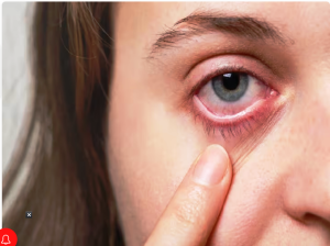 Red Eyes Infection: क्या आपकी हमेशा लाल रहती है आंखें? रसोई की इस चीज को आजमाने से मिलेगा एकदम आराम