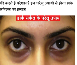 Dark Circles Home Remedies: आंखों के नीचे काले घेरे करते हैं परेशान? इन घरेलू उपायों से होगा डार्क सर्कल्स का इलाज