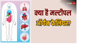 Multiple Organ Failure: क्या है मल्टीपल ऑर्गन फेलियर? शरीर पर होता है ऐसा असर...जानें लक्षण और कारण