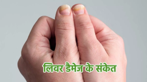 नाखूनों में हो रहे हैं इस तरह के बदलाव तो न करें नजरअंदाज, हो सकता है 'लिवर डैमेज' का खतरा
