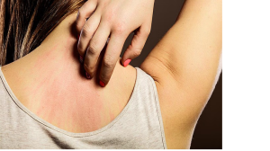 Allergy Problem: कहीं आपको भी तो नहीं है एलर्जी की समस्या? बार-बार होती हैं ये दिक्कतें तो हो जाइए अलर्ट