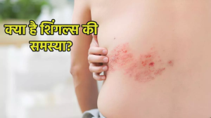 Shingles Awareness Week 2024: त्वचा से जुड़ी गंभीर बीमारी है शिंगल्स, इन लोगों को होता है इसका ज्यादा खतरा