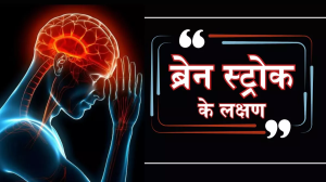 Stroke: युवाओं में बढ़ रहे हैं स्ट्रोक के मामले, इन बातों का ख्याल रख, कर सकते हैं बचाव