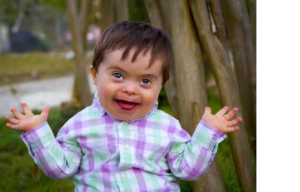 क्या होता है Down Syndrome? जानें इस बीमारी के कारण और लक्षण