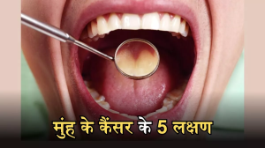 शरीर में दिखने वाले ये 5 लक्षण, चीख-चीखकर देते हैं Oral Cancer का संकेत! वक्त रहते हो जाएं सावधान