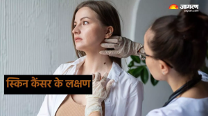 Skin Cancer की ओर इशारा करते हैं त्वचा में होने वाले ये बदलाव, नजरअंदाज करने की गलती पड़ सकती है भारी