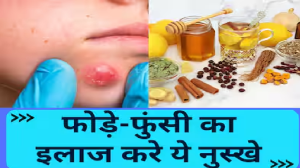 हाथ-पैरों पर दाने और फुंसी का इलाज कर सकते है ये 5 असरदार नुस्खा, रैशज और खुजली से भी पाएं छुटकारा
