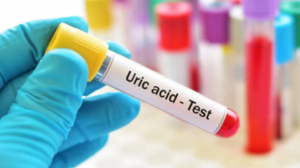 कई समस्याओं की वजह बन सकता है शरीर में बढ़ा हुआ Uric Acid, इन 5 प्रभावी तरीकों से करें इसे कम