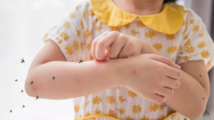 कई गंभीर बीमारियों की वजह बन सकते हैं मच्छर, इस टिप्स से करें बचाव