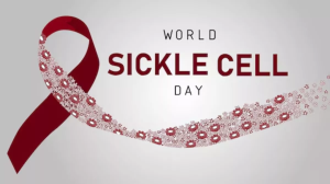 World Sickle Cell Day 2024: अक्सर अनदेखा करने वाले ये लक्षण हो सकते हैं सिकल सेल डिजीज का संकेत