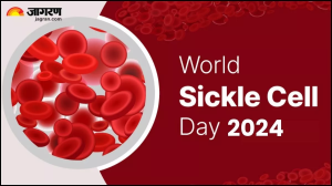 World Sickle Cell Day 2024: क्या है सिकल सेल बीमारी, जानें इसके लक्षण, बचाव और उपचार के तरीके