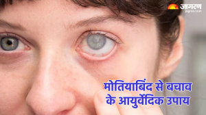 Eyes Care Tips: मोतियाबिंद की रोकथाम में बेहद असरदार हैं ये आयुर्वेदिक उपाय