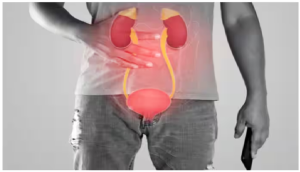 ब्लैडर कैंसर के खतरे को कई गुना बढ़ा सकता है धूम्रपान, इन बातों का रखें ध्यान