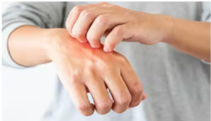 रातभर हाथ-पैरों में होती रहती है खुजली तो समझ लीजिए खतरे में है आपका लिवर !