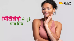 World Vitiligo Day 2024: छूने से फैलती है सफेद दाग की बीमारी, जानें विटिलिगो से जुड़े ऐसे ही मिथकों की सच्चाई