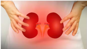 खाने में नमक, शरीर में फ्लूइड्स की मात्रा कम करके हो सकता है किडनी का इलाज : अध्ययन