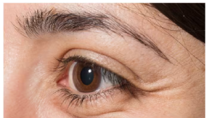 आंखों को घुमाने में होती है दिक्कत? कहीं ये ब्रेन ट्यूमर का इशारा तो नहीं