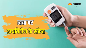 https://www.jagran.com/lifestyle/health-high-blood-sugar-symptoms-on-skin-twacha-par-diabetes-ke-sanket-23752316.html