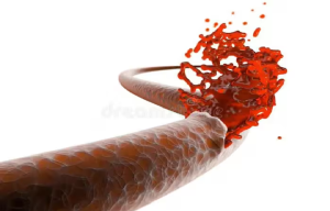 धमनियों के फटने से पहले शरीर में दिखते हैं ये 5 लक्षण, इस तरह भांप सकते हैं Heart Attack का खतरा