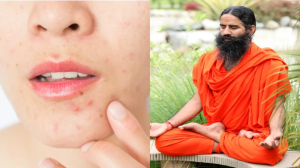 उमस से बढ़ जाती है स्किन की कई परेशानी...मॉनसून में खिली-खिली त्वचा पाने के लिए आज़माए बाबा रामदेव के ये उपाय
