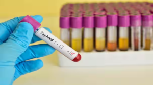 टाइफॉइड (Typhoid)
