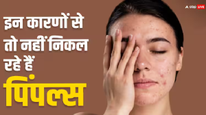चेहरे पर निकल रहे हैं लंबे समय से दाने, घरेलू उपाय से नहीं हो रहे ठीक तो कहीं ये हार्मोनल प्रॉब्लम तो नहीं?