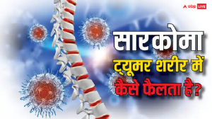 Sarcoma: शरीर के किन अंगों में सारकोमा ट्यूमर फैलने का रहता है सबसे ज्यादा खतरा? आइए जानें इसके लक्षण
