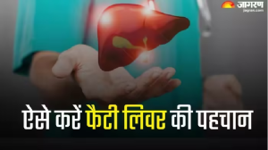 गंभीर रूप ले सकती है Fatty Liver की समस्या, 3 टेस्ट की मदद से करें समय रहते इसकी पहचान