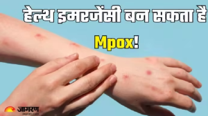 अफ्रीकी देशों में कोहराम मचा रहा Mpox, WHO के बताए लक्षण दिखने पर हो जाएं सावधान