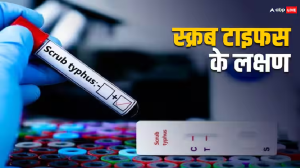Scrub Typhus: शिमला में स्क्रब टाइफस से हुई पहली मौत, जानें इस बीमारी के लक्षण और बचाव का तरीका