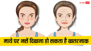 Forhead Veins: क्या आपके माथे पर भी दिख रही हैं नसें? जानें कैसे हो सकता है ये खतरनाक