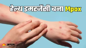 अफ्रीका-स्वीडन के बाद अब Mpox ने पाकिस्तान में दी दस्तक, WHO ने किया हेल्थ इमरजेंसी का एलान