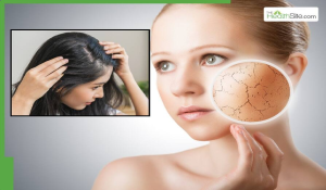 स्किन व बालों पर यूज करती हैं Hard water? तो फिर जान लें इससे होने वाले 4 नुकसान