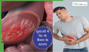 इन 5 कारणों से युवाओं में बढ़ रहे हैं पेट में कैंसर के मामले, बचाव के लिए अपनाएं जरूरी टिप्स