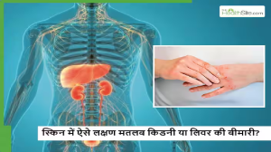 स्किन से ही पता लग जाएगा किडनी-लिवर हो रहा डैमेज, बचना चाहते हैं तो इन 5 संकेतों को न करें इग्नोर