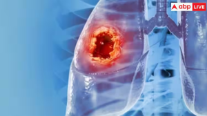 Lung Cancer Symptoms: लंग्स कैंसर होने पर शरीर पर दिखने लगते हैं ये लक्षण, बिल्कुल न करें नजरअंदाज