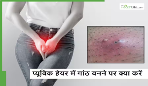 Lump in pubic area: इन 5 कारणों से होने लगती है प्यूबिक हेयर में गांठ, इन घरेलू तरीकों से करें बचाव