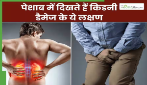 सुबह पेशाब का रंग हो ऐसा तो हो जाएं अलर्ट, अंदर ही अंदर बर्बाद हो रही किडनी का हो सकता है ये लक्षण