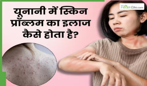 यूनानी मेडिसिन में त्वचा संबंधी समस्याओं को कैसे ठीक किया जाता है? जानें 5 कारगर उपाय