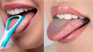 जीभ साफ नहीं करने से क्या होता है, जानें दांतों के साथ Tongue Cleaning भी क्यों है ज़रूरी ?